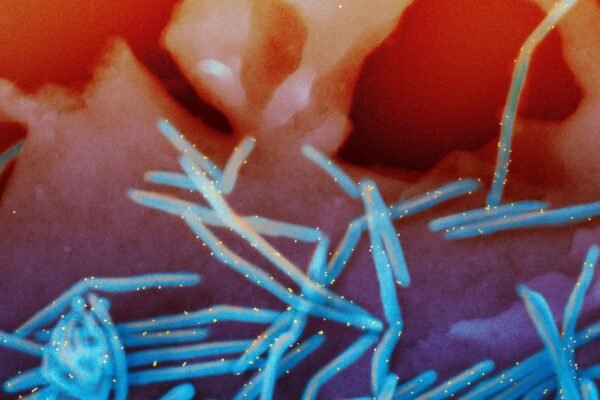 Experts make new recommendations on RSV vaccines and meningitis, but it is not clear what happens after