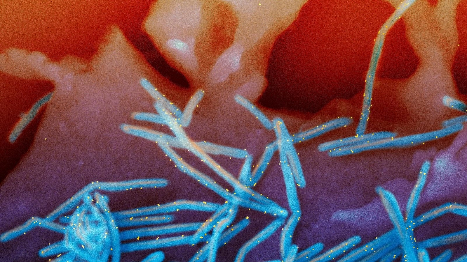 Experts make new recommendations on RSV vaccines and meningitis, but it is not clear what happens after