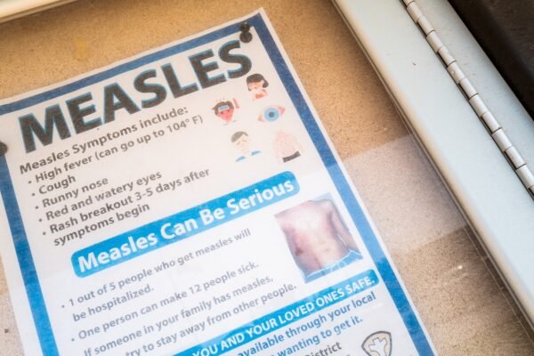 Michigan reports first confirmed the measles outbreak since 2019