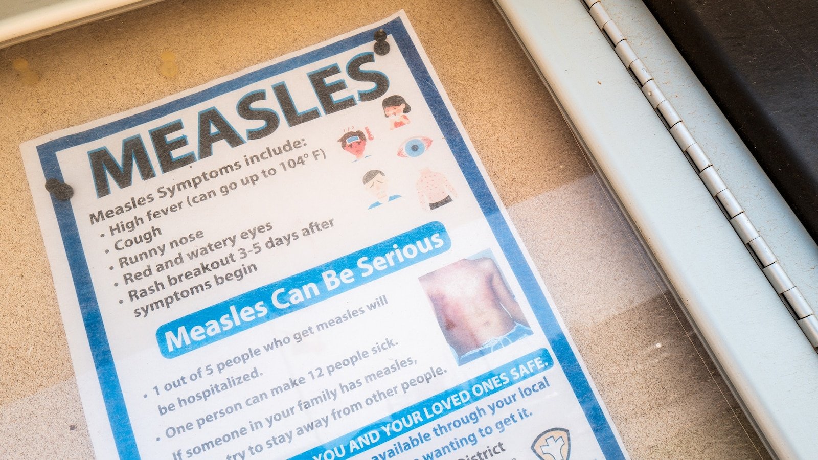 Michigan reports first confirmed the measles outbreak since 2019